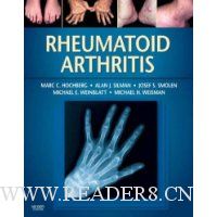  Rheumatoid Arthritis