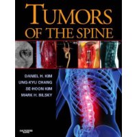  Tumors of the Spine