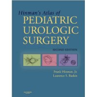  Hinman's Atlas Of Pediatric Urologic Surgery