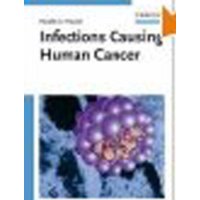  Infections Causing Human Cancer