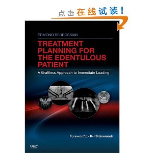 Implant Treatment Planning for the Edentulous Patient: A Graftless Approach to Immediate Loading